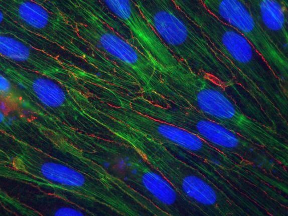 Cerebral endothelial cells (ZO-1, red; phalloidin, blue; Hoechst, green; by courtesy of I. Krizbai, Szeged/Hungary)